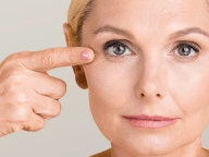Blefaroplastia Blefaroplastia.